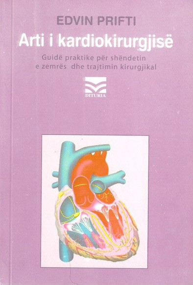Arti i kardiokirurgjise