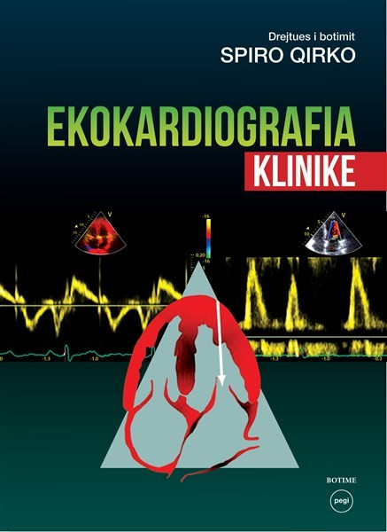 Ekokardiografia klinike